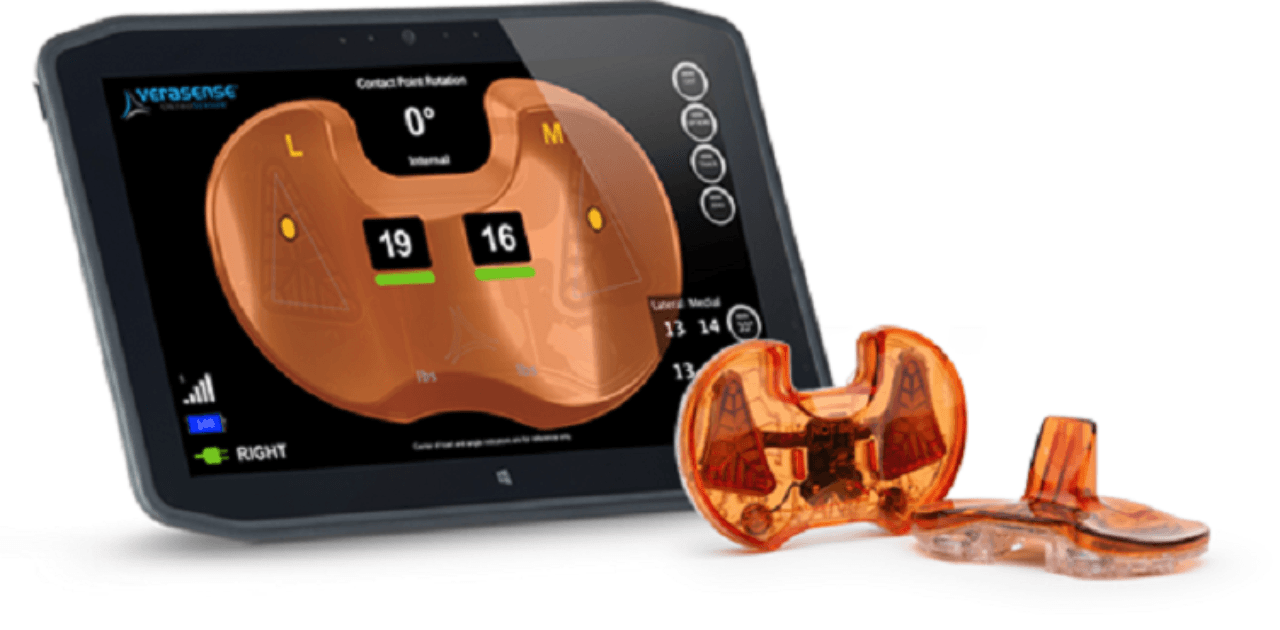 Smart Implants: Merging Technology with Human Biology