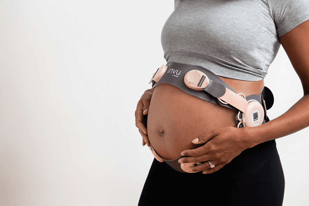 Remote Fetal Monitoring Using Wearables: Keeping Tabs on Baby’s Health from Home