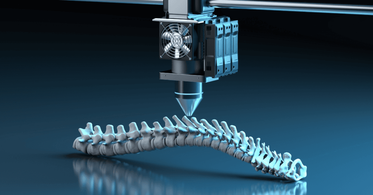 3D Printing in Healthcare: Custom Prosthetics and Bioprinting Organs