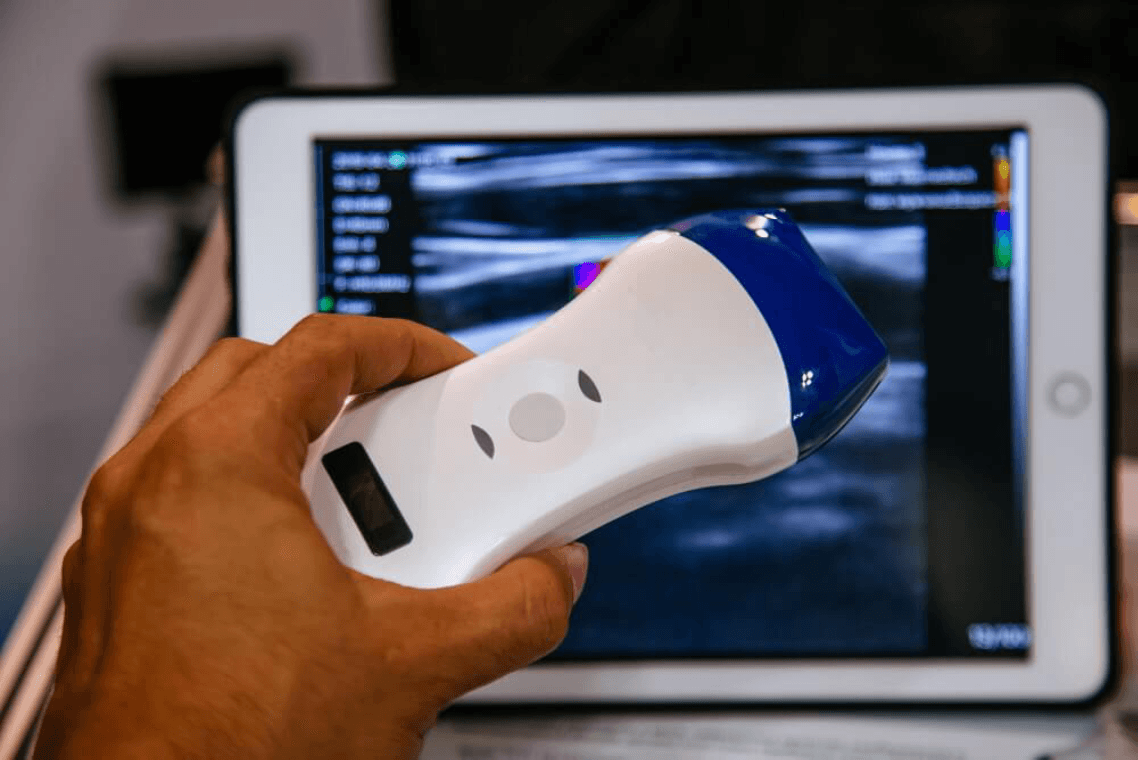 Remote Pregnancy Monitoring with Smart Ultrasound Devices