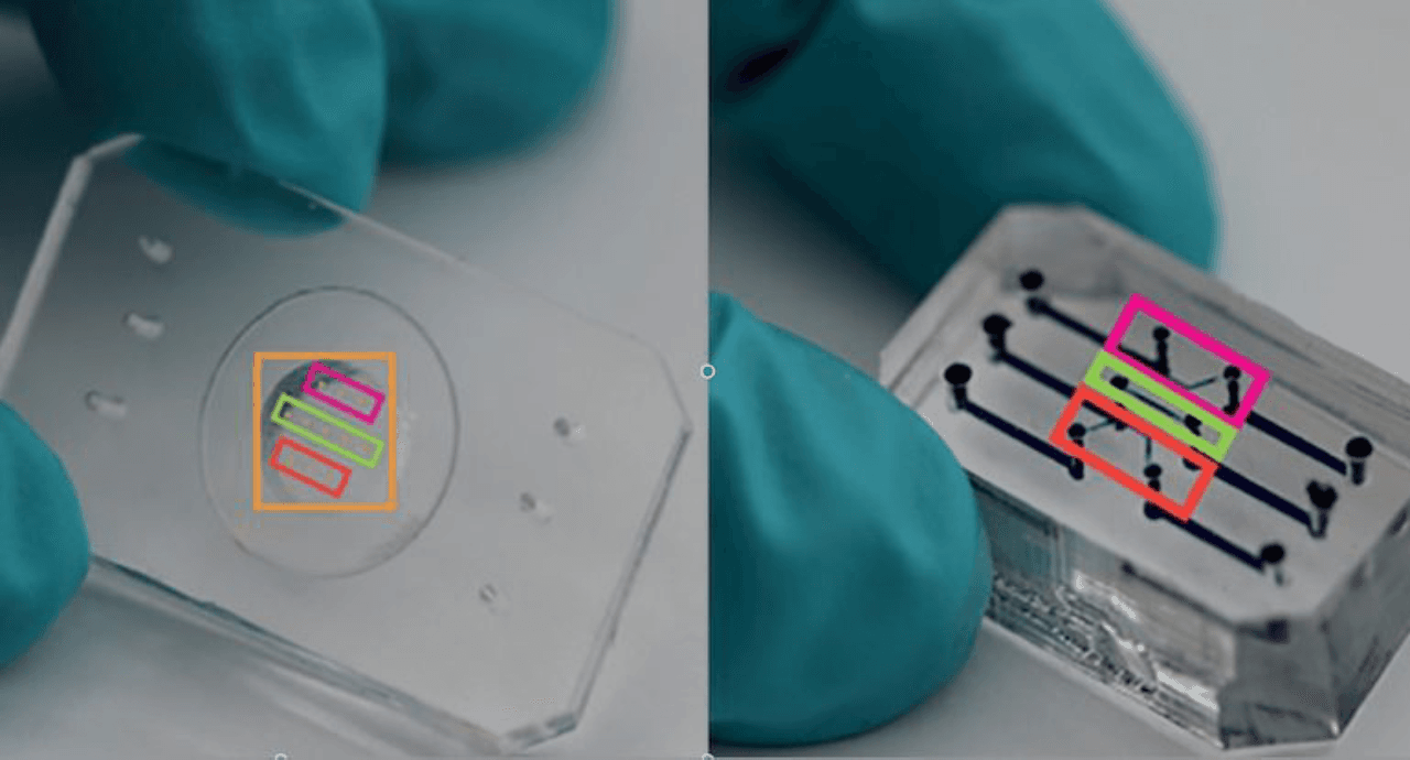 From Wearables to Predictables: How AI-Powered Biosensors Are Personalizing Preventive Healthcare